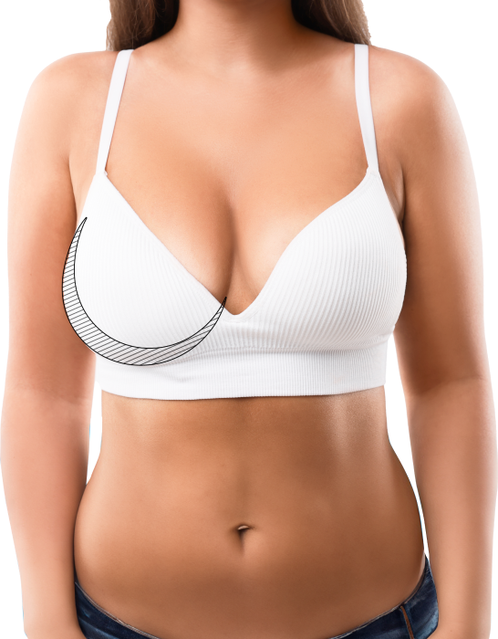 Brustverkleinerung Chirurgie