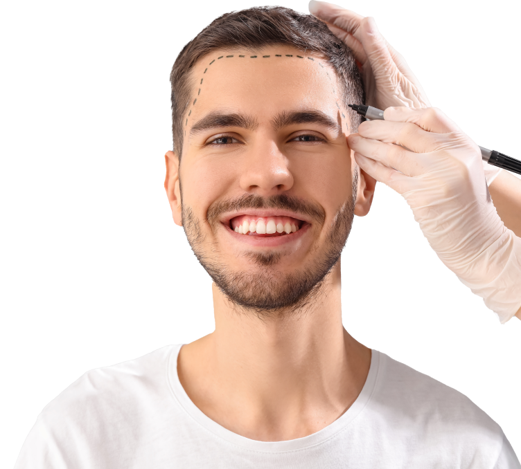 FUE-Haartransplantation